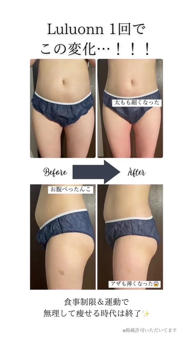 ルルオン1回の効果